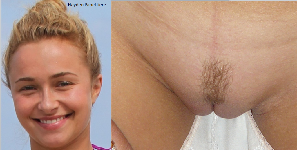 Hayden Panettiere Nuda Anni In Pussy Portraits My XXX Hot Girl