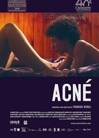 Acné (2008) Scene Nuda